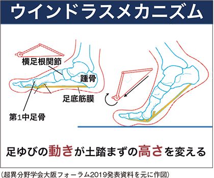 ウインドラスメカニズム